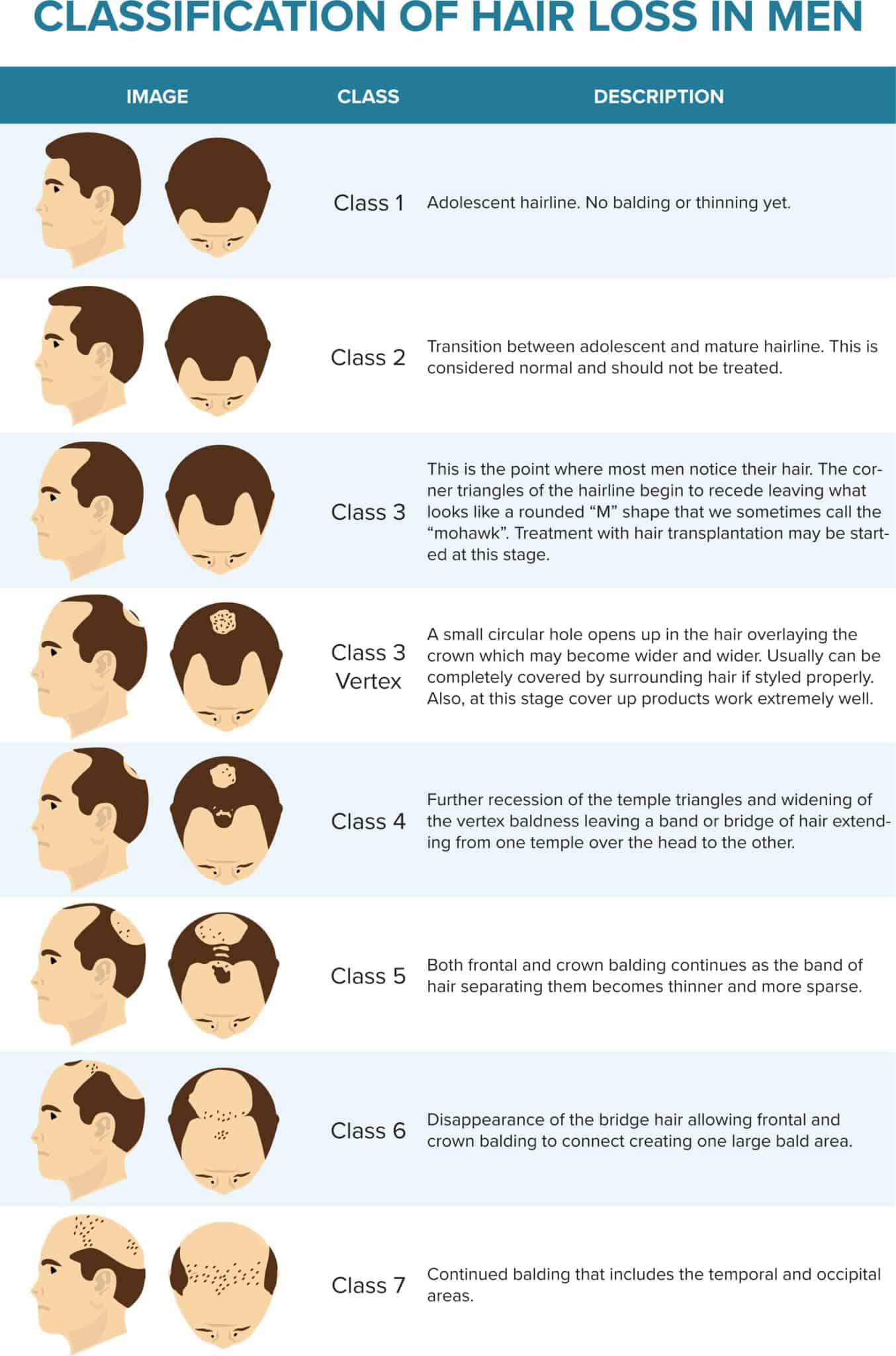 Types of Hair Loss for Men in New York | Feller and Bloxham Medical