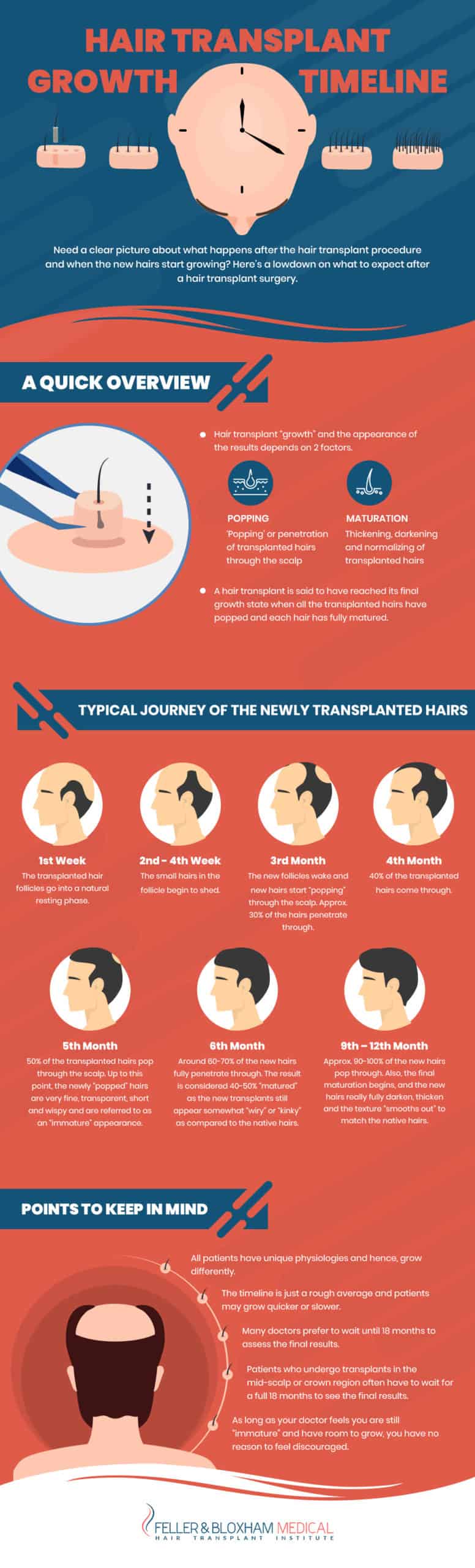 Overview of Hair Transplant Growth Timeline