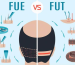 FUT vs FUE