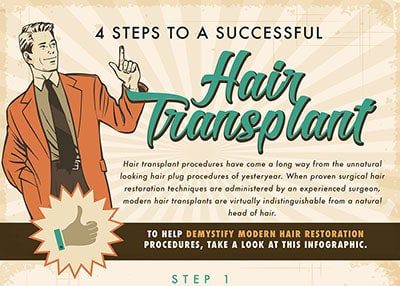 4 Steps to a Successful Hair Transplant