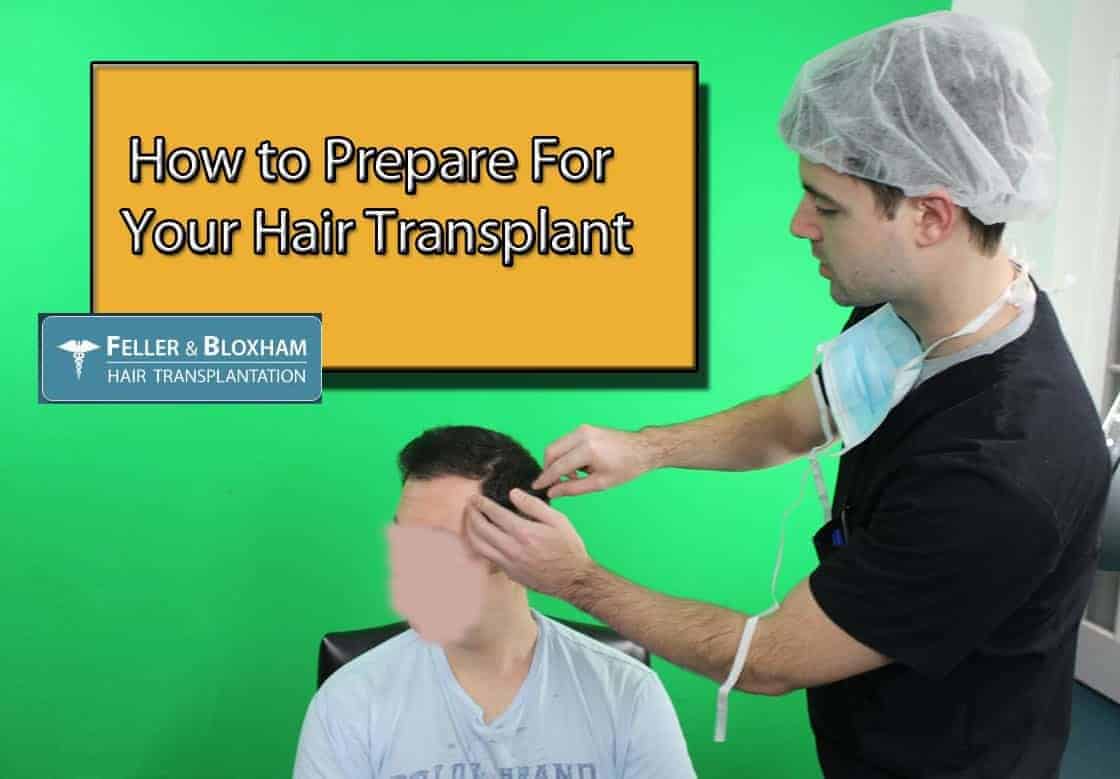 How to Prepare For Your Hair Transplant