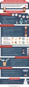 A Quick Overview of the Hair Transplant Process