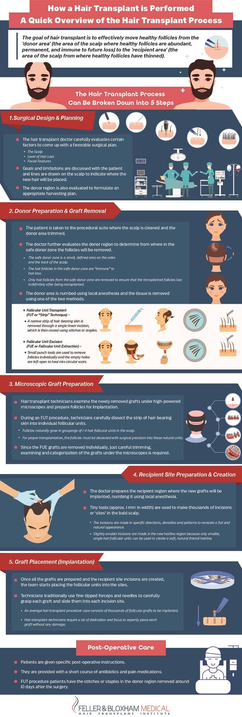 A Quick Overview of the Hair Transplant Process