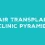 Hair Transplant Clinic Pyramid